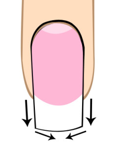 schema limage