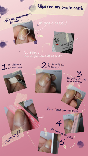 reparer un ongle casse